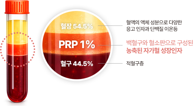 혈장 54.5% - 혈액의 액체 성분으로 다양한 응고 인자과 단백질 이온등 | PRP 1% - 백혈구와 혈소판으로 구성된 농축된 자가혈 성장인자 | 혈구 44.5% - 적혈구층