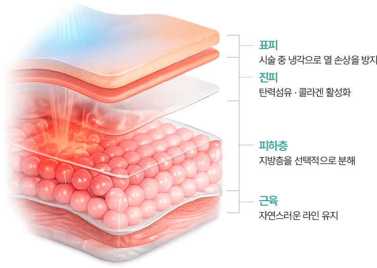 표피 - 시술 중 냉각으로 열 손상을 방지 | 진피 - 탄력섬유 · 콜라겐 활성화 | 피하층 - 지방층을 선택적으로 분해 | 근육 - 자연스러운 라인 유지