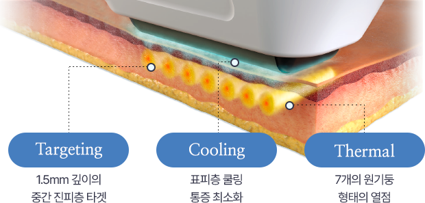 Targeting - 1.5mm 깊이의 중간 진피층 타겟 | Cooling - 표피층 쿨링 통증 최소화 | Thermal - 7개의 원기둥 형태의 열점