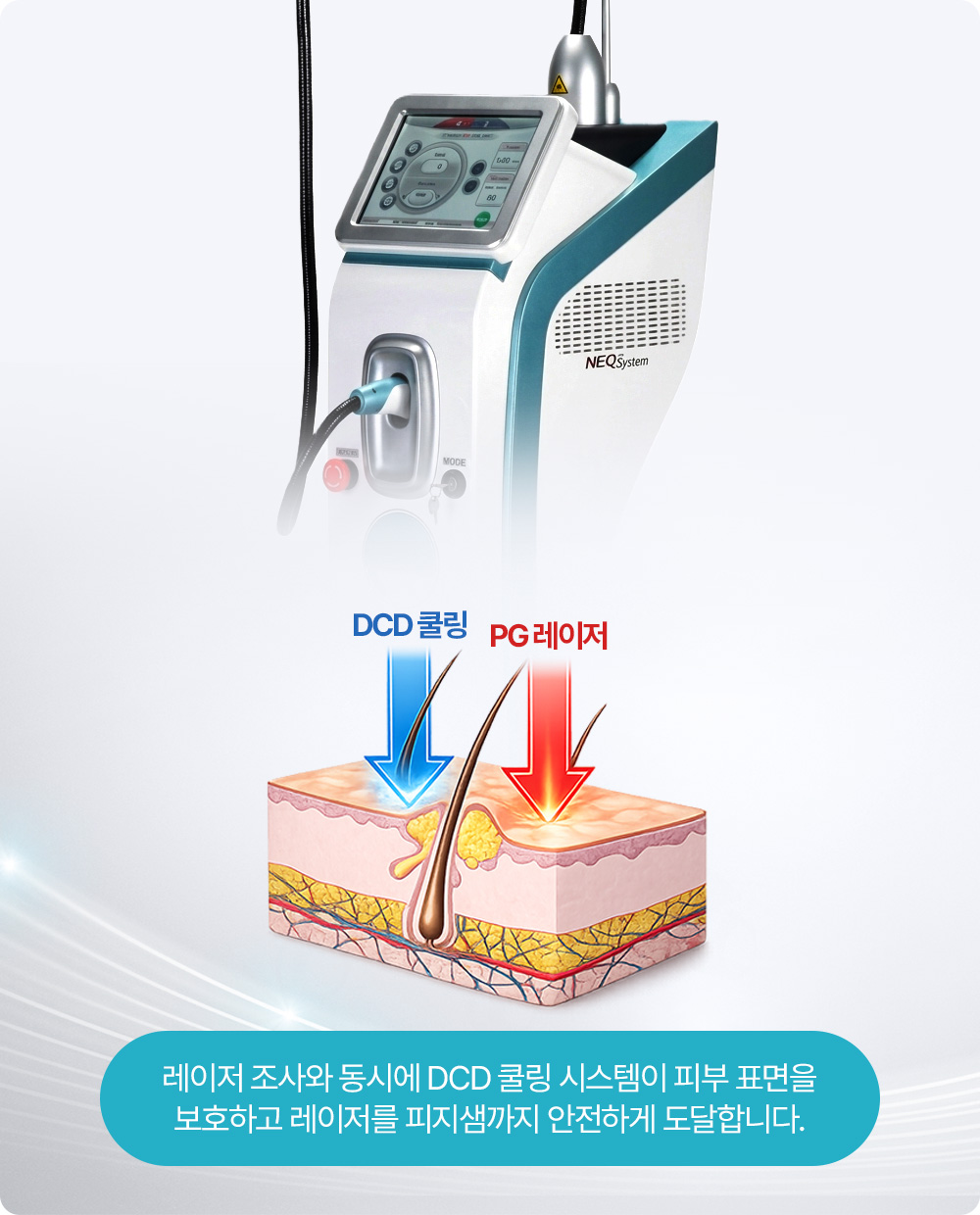 레이저 조사와 동시에 DCD 쿨링 시스템이 피부 표면을 보호하고 레이저를 피지샘까지 안전하게 도달합니다.