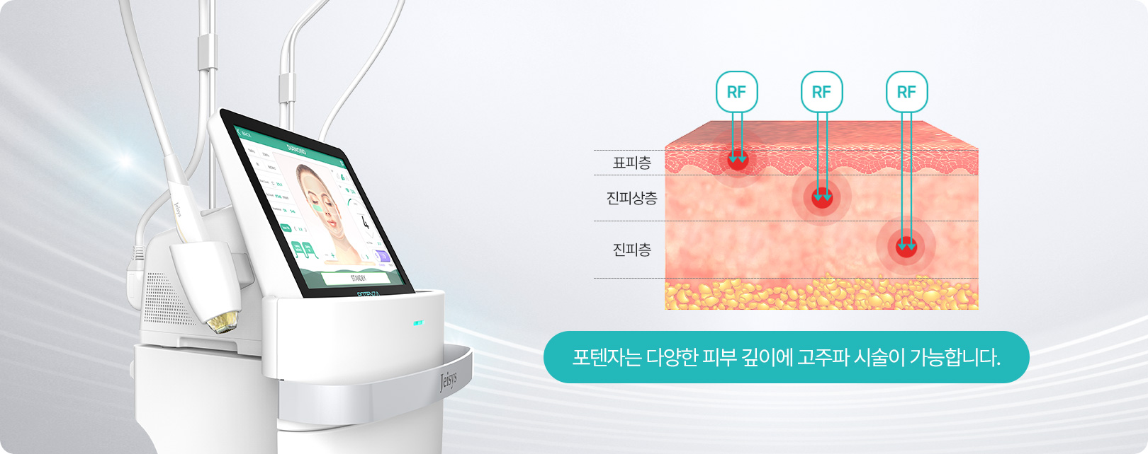 포텐자는 다양한 피부 깊이에 고주파 시술이 가능합니다.