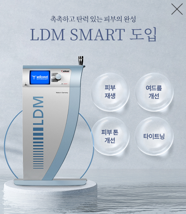 LDM 도입